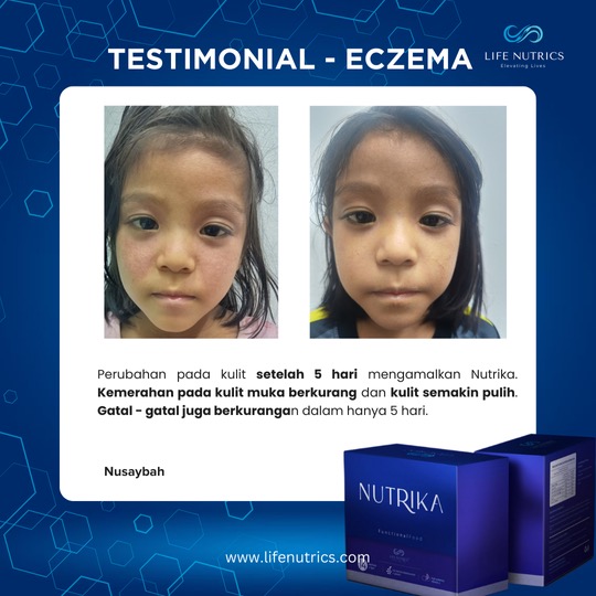 Kebas Tangan & Sakit Sendi
