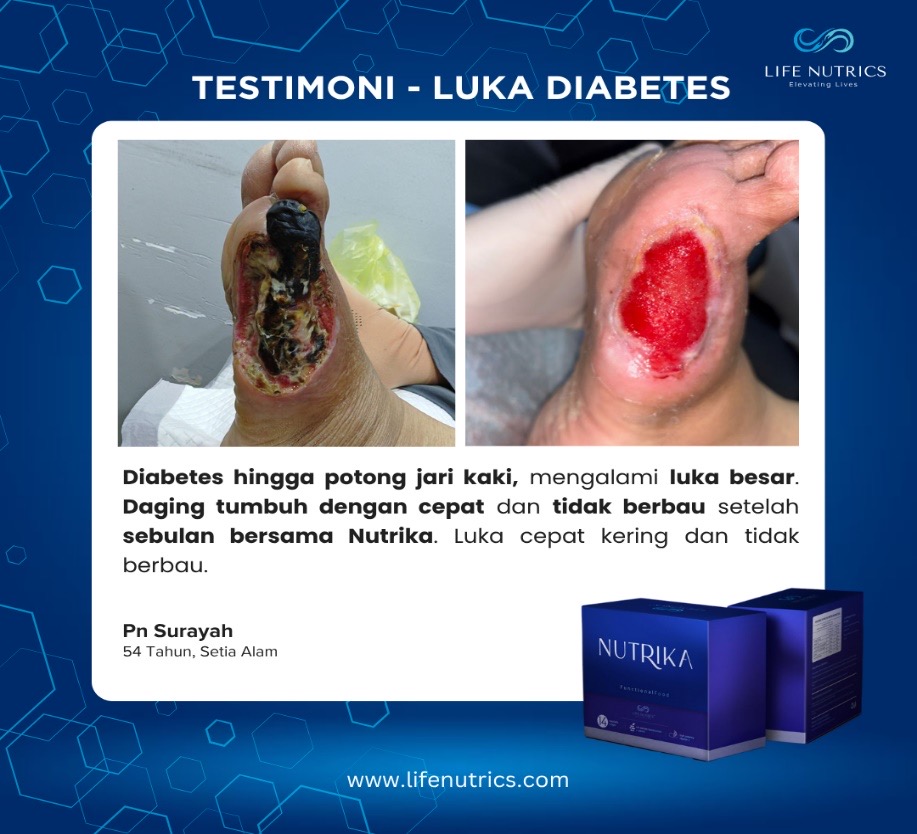Asma Kronik Berbelas Tahun